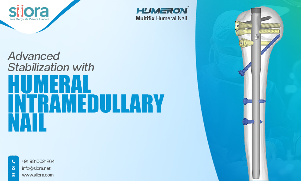 Future of Shoulder Fracture Fixation: The Role of Next-Gen Humeral Nails